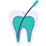 advanced root canal treatment