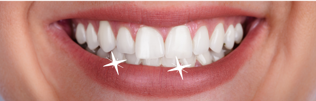 AFTER DENTAL TREATMENT