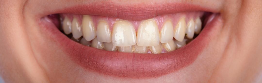 BEFORE DENTAL TREATMENT